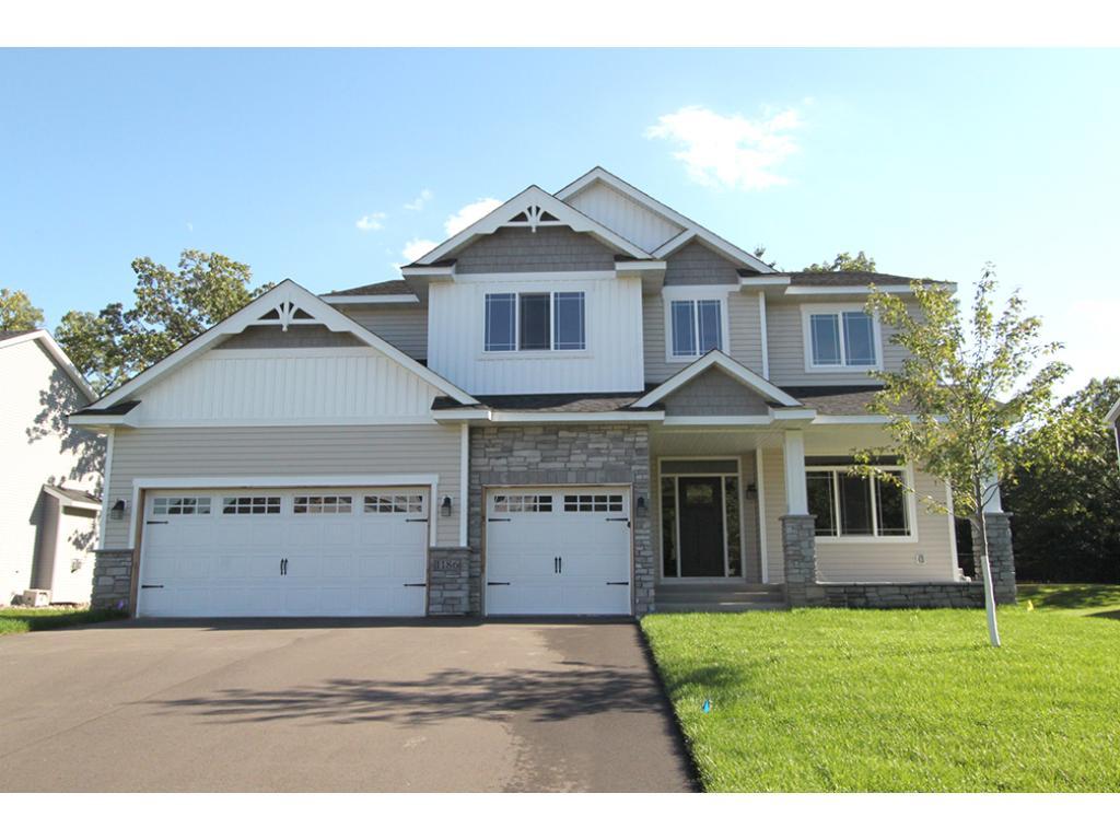 View of Residential at 1186 150th Lane, Andover MN 55304, Andover - Mike Wilen | Minnesota Team Real Estate