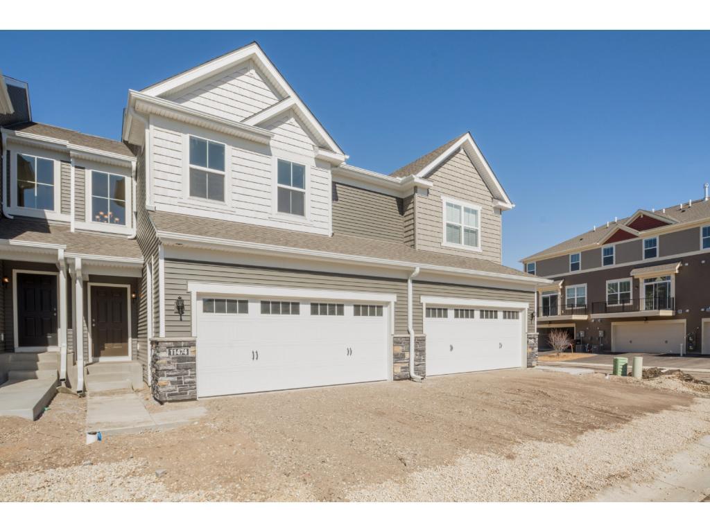 View of Residential at 11474 81st Place, Maple Grove MN 55369, Maple Grove - Mike Wilen | Minnesota Team Real Estate