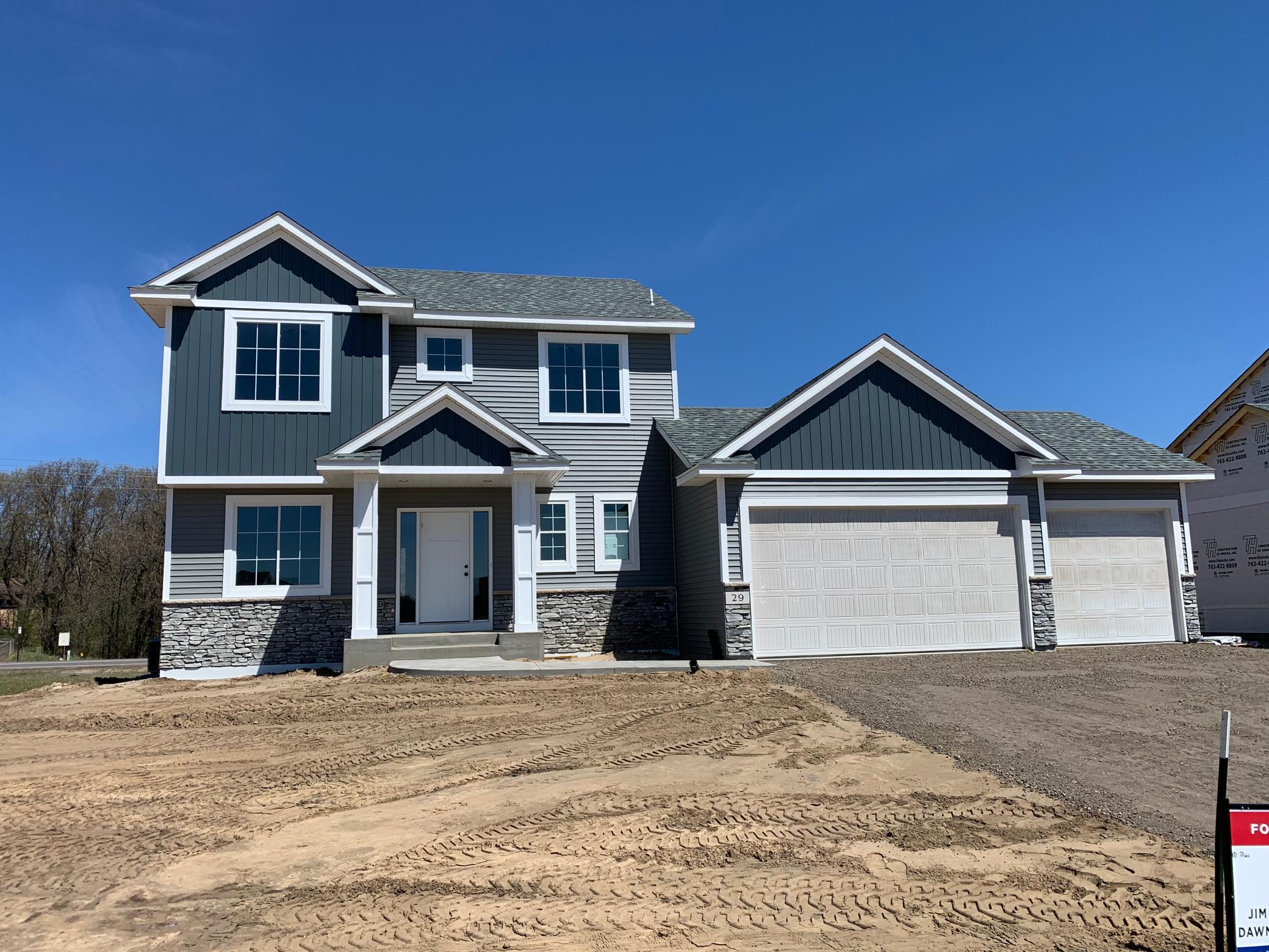 View of Residential at 29 144th Lane, Andover MN 55304, Andover - Mike Wilen | Minnesota Team Real Estate