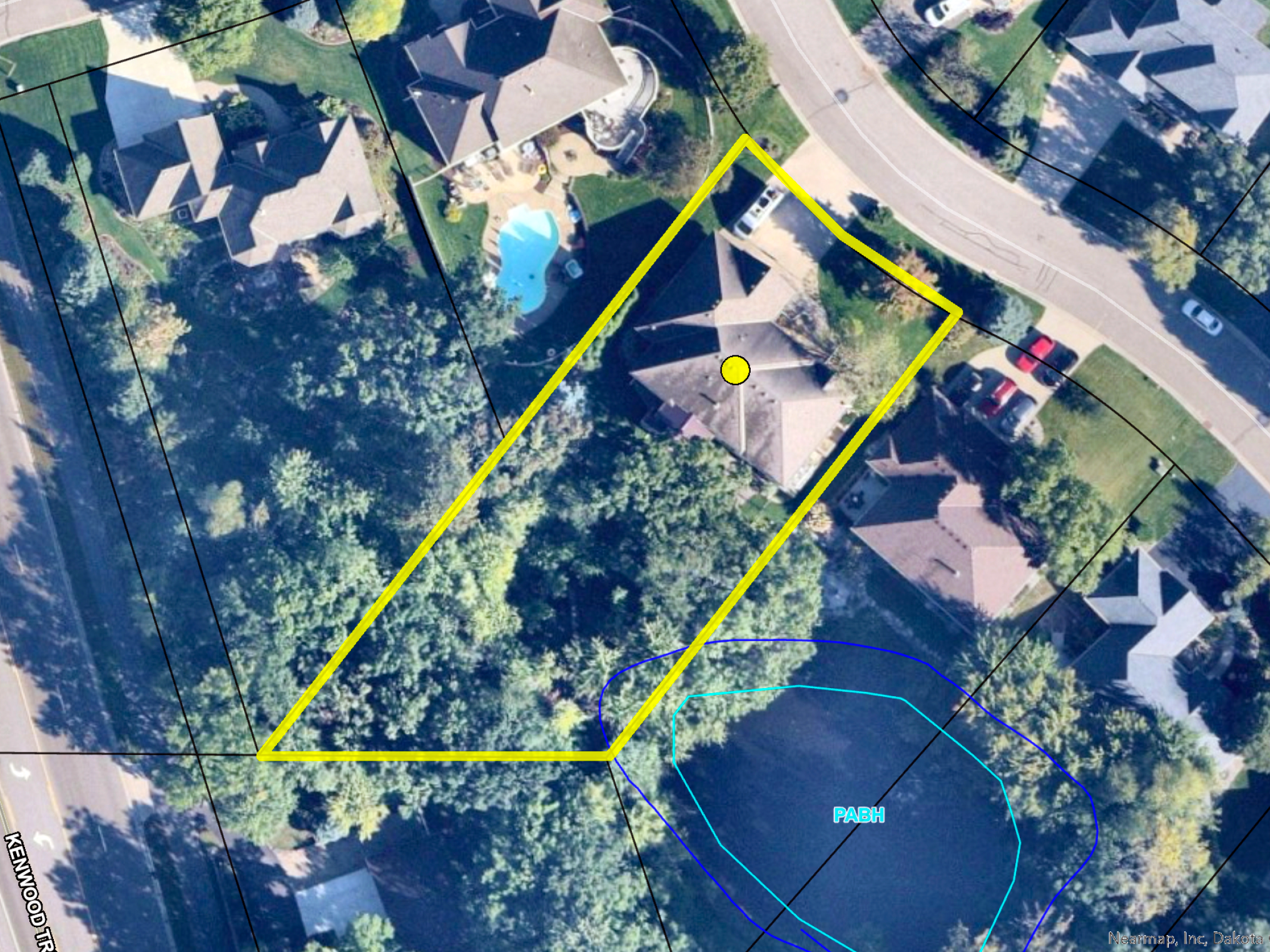 View of Residential at 11312 Kenworth Lane, Lakeville MN 55044, Lakeville (53 of 56) - Mike Wilen | Minnesota Team Real Estate