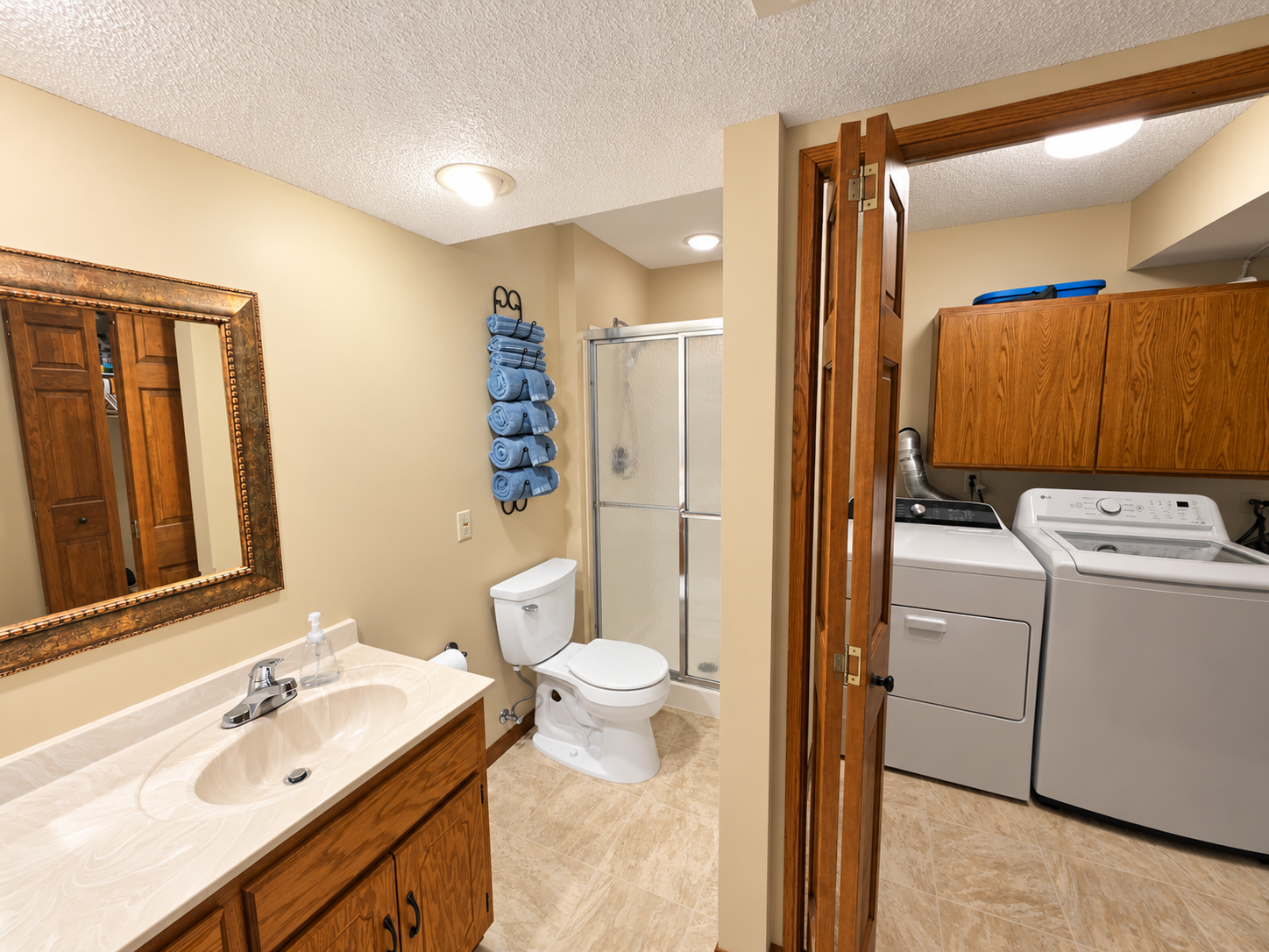 View of Residential at 14579 Embry Path, Apple Valley MN 55124, Apple Valley (12 of 22) - Mike Wilen | Minnesota Team Real Estate