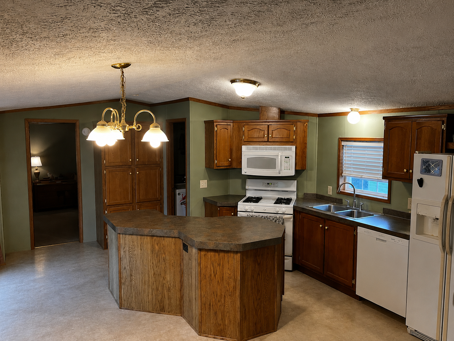 View of Residential at 1623 Hall Street, Shoreview MN 55126, Shoreview (2 of 9) - Mike Wilen | Minnesota Team Real Estate