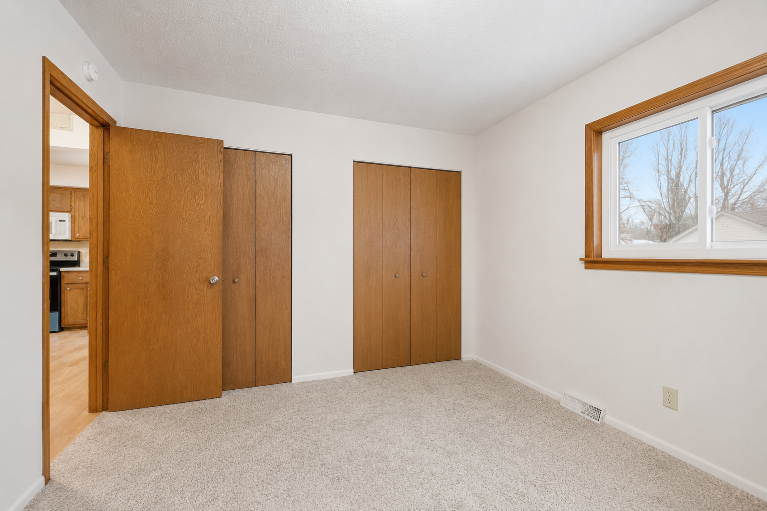 View of Residential at 1561 Clarence Street, Saint Paul MN 55106, Saint Paul (12 of 20) - Mike Wilen | Minnesota Team Real Estate