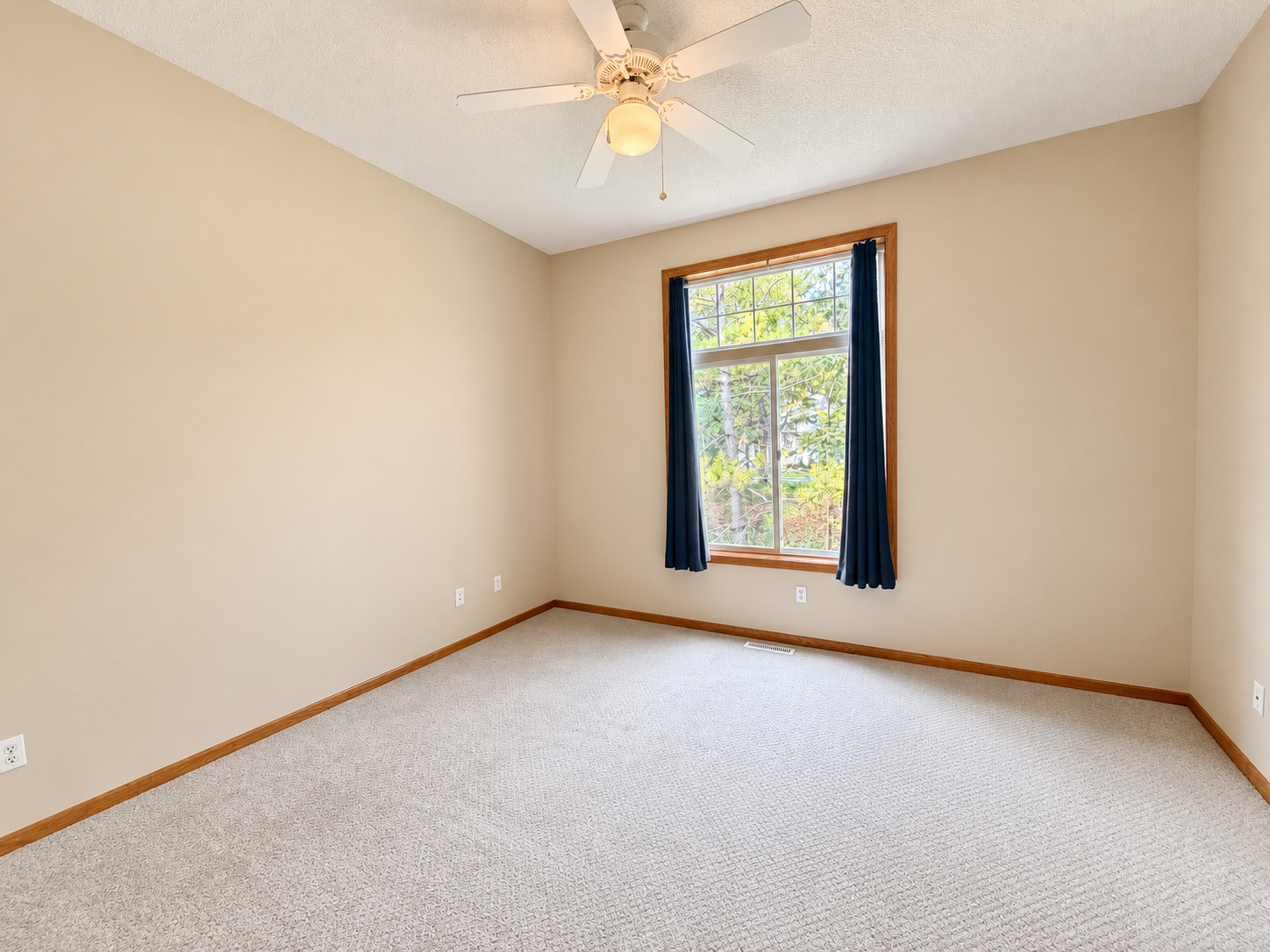 View of Residential at 3771 Burgundy Drive, Eagan MN 55122, Eagan (15 of 32) - Mike Wilen | Minnesota Team Real Estate
