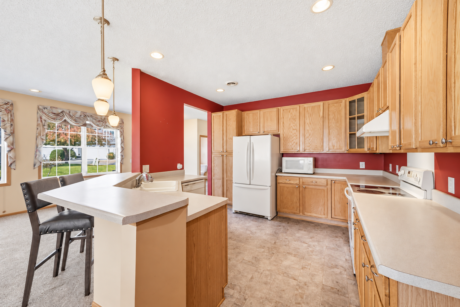 View of Residential at 17716 68th Place, Maple Grove MN 55311, Maple Grove (14 of 33) - Mike Wilen | Minnesota Team Real Estate