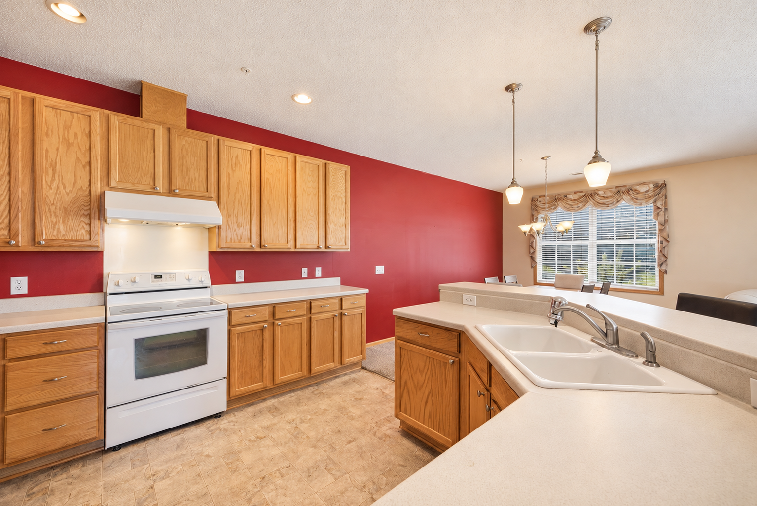 View of Residential at 17716 68th Place, Maple Grove MN 55311, Maple Grove (18 of 33) - Mike Wilen | Minnesota Team Real Estate
